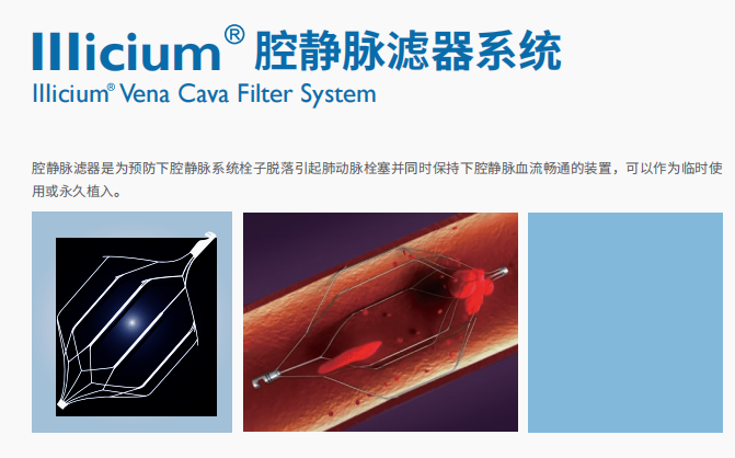 威海維心腔靜脈濾器系統wxf-32